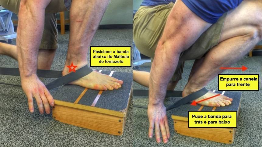 Trabalhando a mobilidade do tornozelo utilizando bandas elásticas
